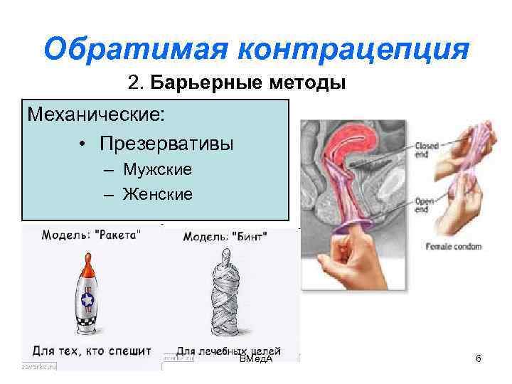 Обратимая контрацепция 2. Барьерные методы Механические: • Презервативы – Мужские – Женские ВМед. А