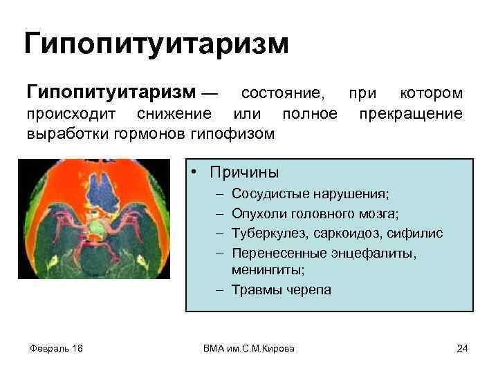 Гипопитуитаризм — состояние, при котором происходит снижение или полное выработки гормонов гипофизом прекращение •