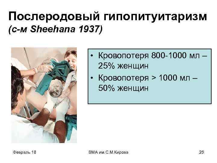 Послеродовый гипопитуитаризм (с-м Sheehana 1937) • Кровопотеря 800 -1000 мл – 25% женщин •