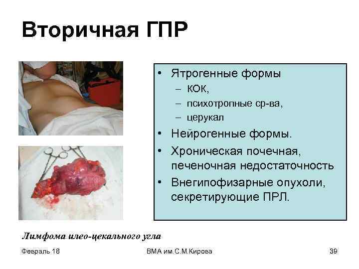 Вторичная ГПР • Ятрогенные формы – КОК, – психотропные ср-ва, – церукал • Нейрогенные