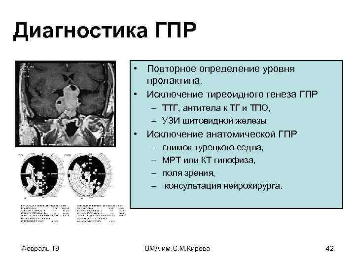 Диагностика ГПР • Повторное определение уровня пролактина. • Исключение тиреоидного генеза ГПР – ТТГ,