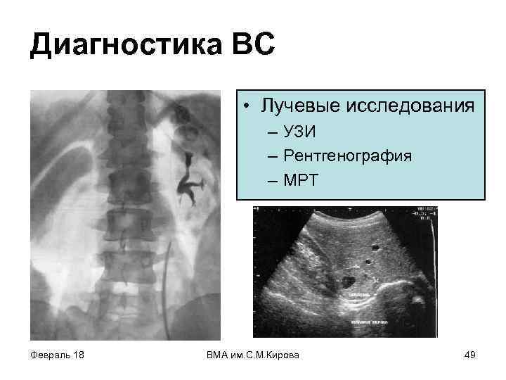 Диагностика ВС • Лучевые исследования – УЗИ – Рентгенография – МРТ Февраль 18 ВМА