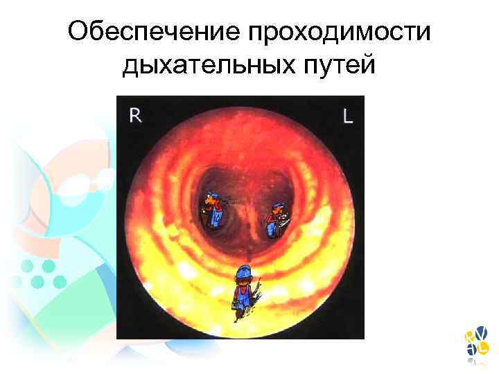 Обеспечение проходимости дыхательных путей 