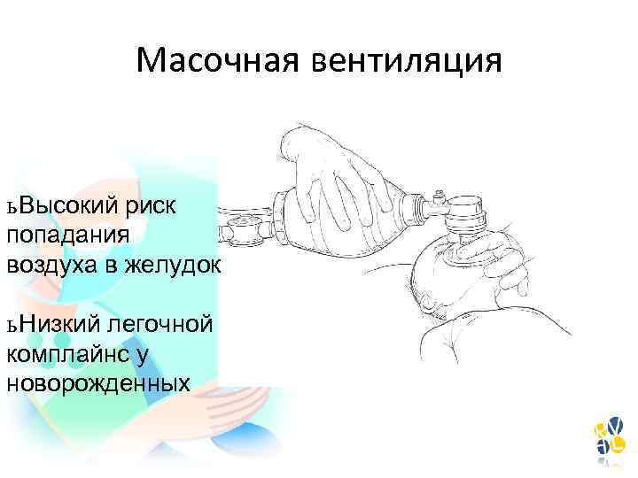 Масочная вентиляция ь Высокий риск попадания воздуха в желудок ь Низкий легочной комплайнс у