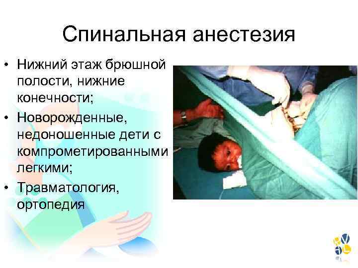 Спинальная анестезия • Нижний этаж брюшной полости, нижние конечности; • Новорожденные, недоношенные дети с