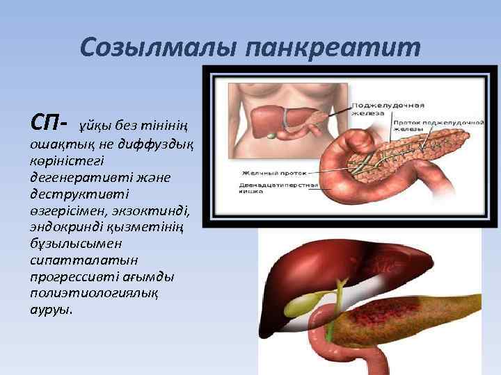 Созылмалы панкреатит СП- ұйқы без тінінің ошақтық не диффуздық көріністегі дегенеративті және деструктивті өзгерісімен,