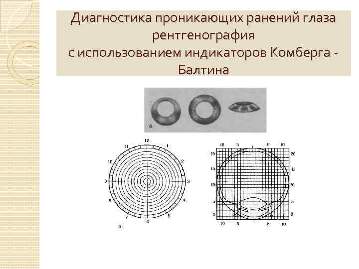 Диагностика проникающих ранений глаза рентгенография с использованием индикаторов Комберга Балтина 