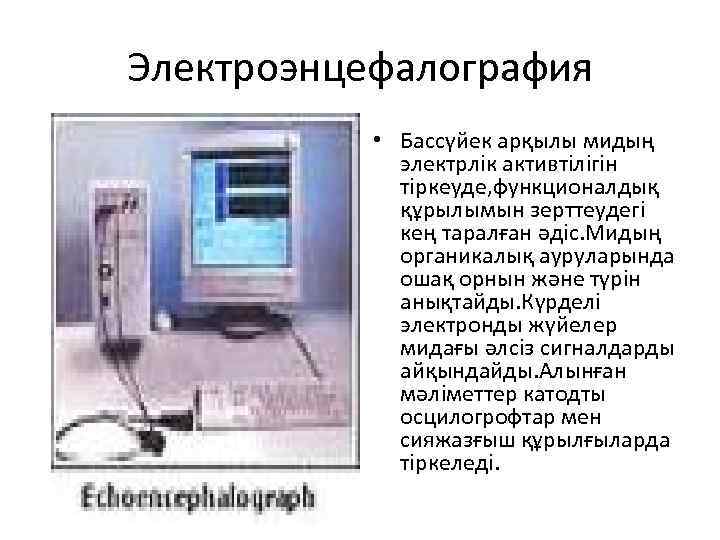 Электроэнцефалография • Бассүйек арқылы мидың электрлік активтілігін тіркеуде, функционалдық құрылымын зерттеудегі кең таралған әдіс.