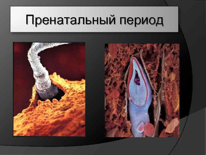 Пренатальный период 