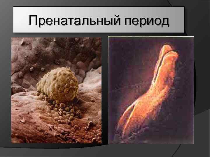 Пренатальный период 