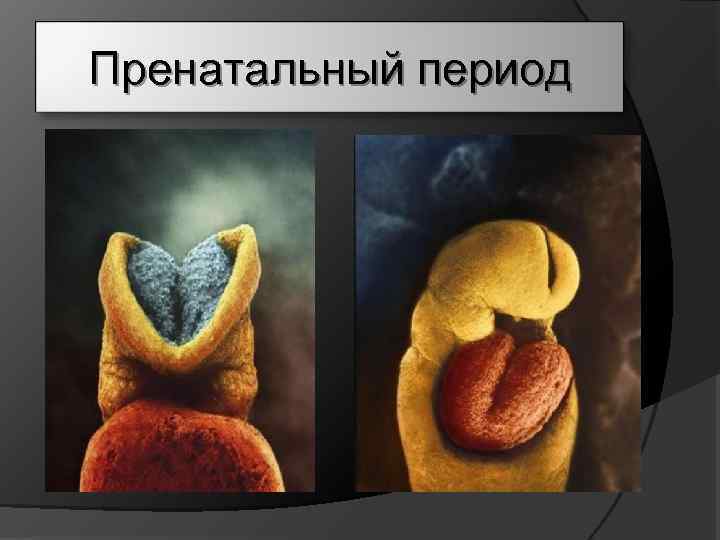 Пренатальный период 