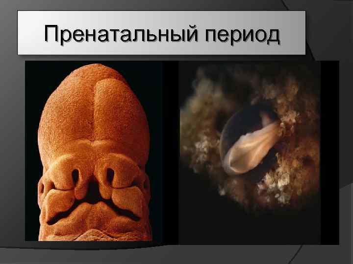 Пренатальный период 