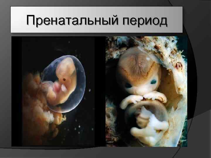 Пренатальный период 