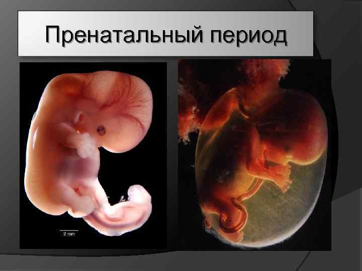 Пренатальный период 