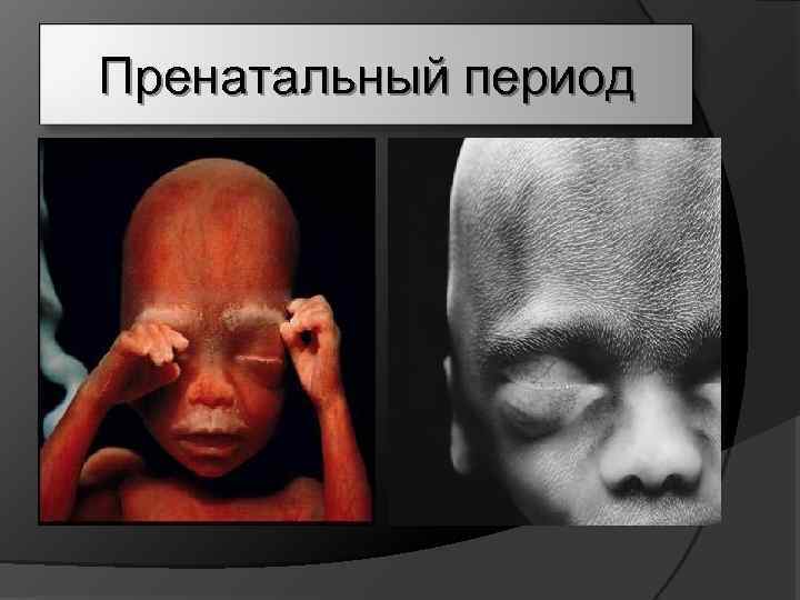Пренатальный период 