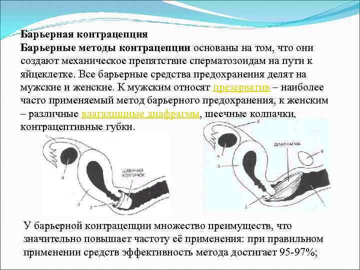 Барьерный способ. Барьерные контрацептивы. Барьерный метод контрацепции. Мужская барьерная контрацепция. Барьерные методы контрацептивов.