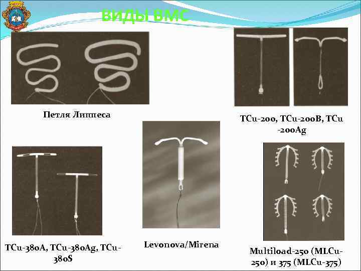 Виды спиралей. Спираль внутриматочная петля Липпса. Внутриматочная контрацепция петля Липпса. Спираль липса внутриматочная. Виды ВМС петля Липпса.