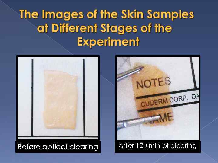 The Images of the Skin Samples at Different Stages of the Experiment Before optical