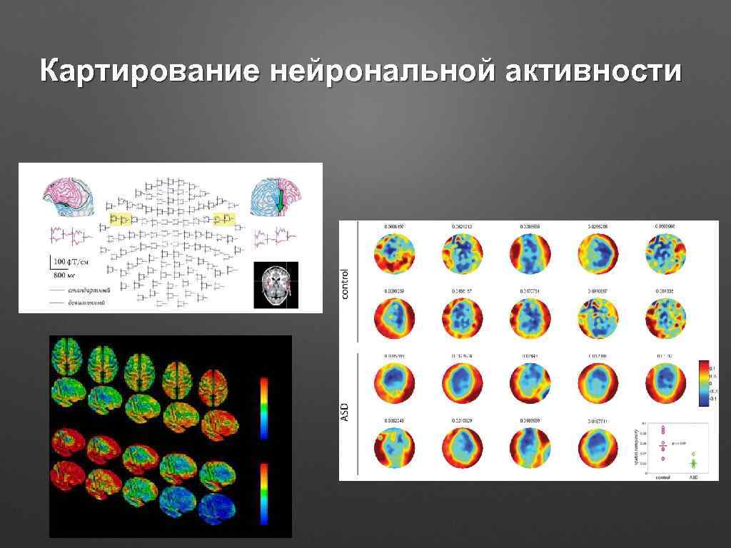 Картирование нейрональной активности 