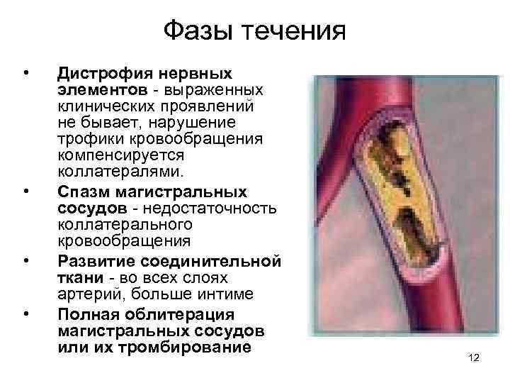 Фазы течения • • Дистрофия нервных элементов - выраженных клинических проявлений не бывает, нарушение