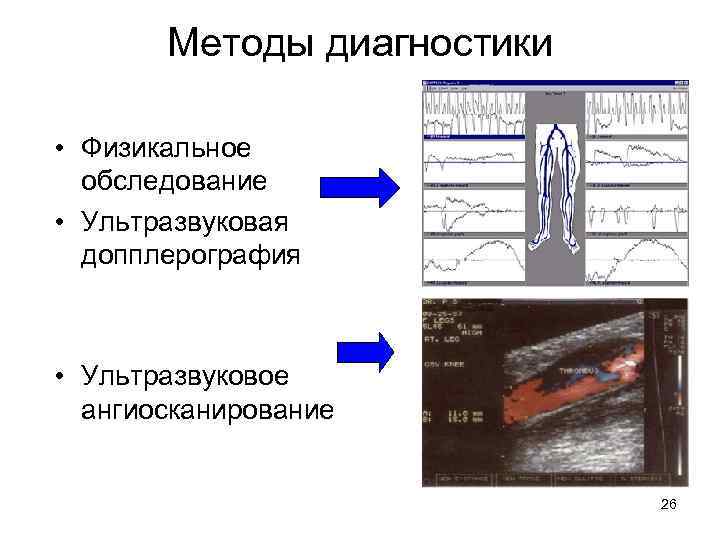 Методы диагностики • Физикальное обследование • Ультразвуковая допплерография • Ультразвуковое ангиосканирование 26 