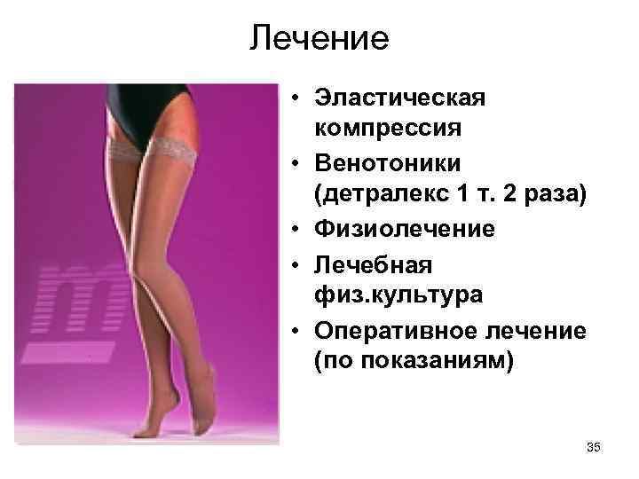 Лечение • Эластическая компрессия • Венотоники (детралекс 1 т. 2 раза) • Физиолечение •