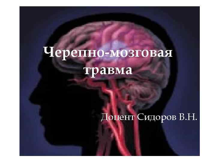 Черепно-мозговая травма Доцент Сидоров В. Н. 