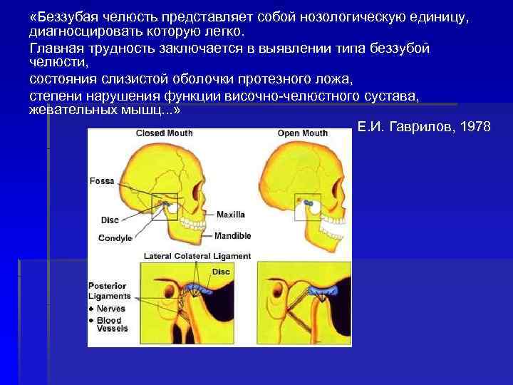  «Беззубая челюсть представляет собой нозологическую единицу, диагносцировать которую легко. Главная трудность заключается в