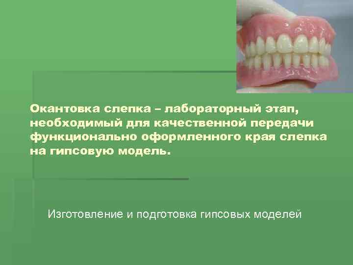Окантовка слепка – лабораторный этап, необходимый для качественной передачи функционально оформленного края слепка на