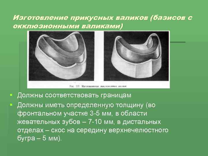Изготовление прикусных валиков (базисов с окклюзионными валиками) § Должны соответствовать границам § Должны иметь