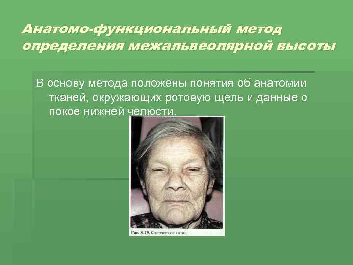 Анатомо-функциональный метод определения межальвеолярной высоты В основу метода положены понятия об анатомии тканей, окружающих