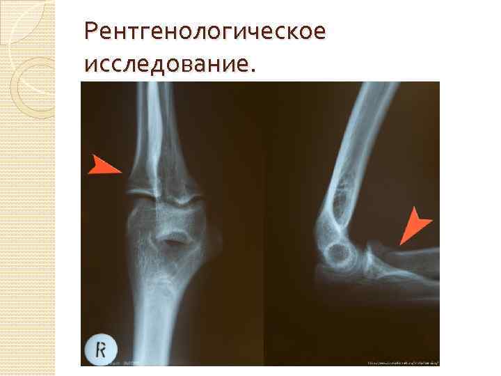 Рентгенологическое исследование. 
