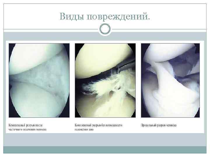 Виды повреждений. 