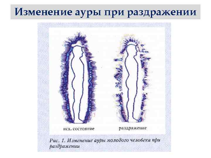Изменение ауры при раздражении 