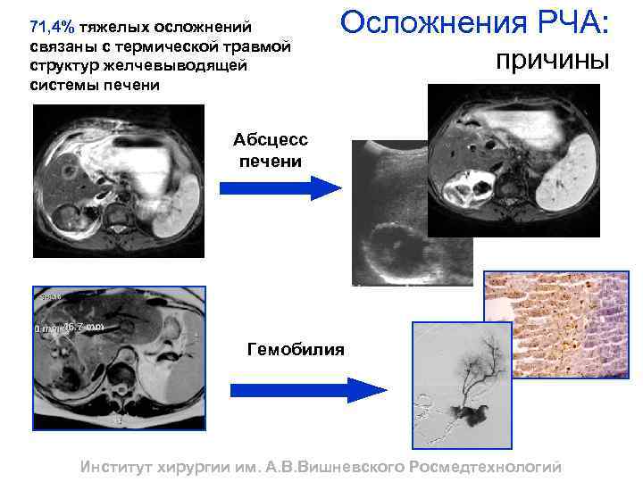 Рча отзывы