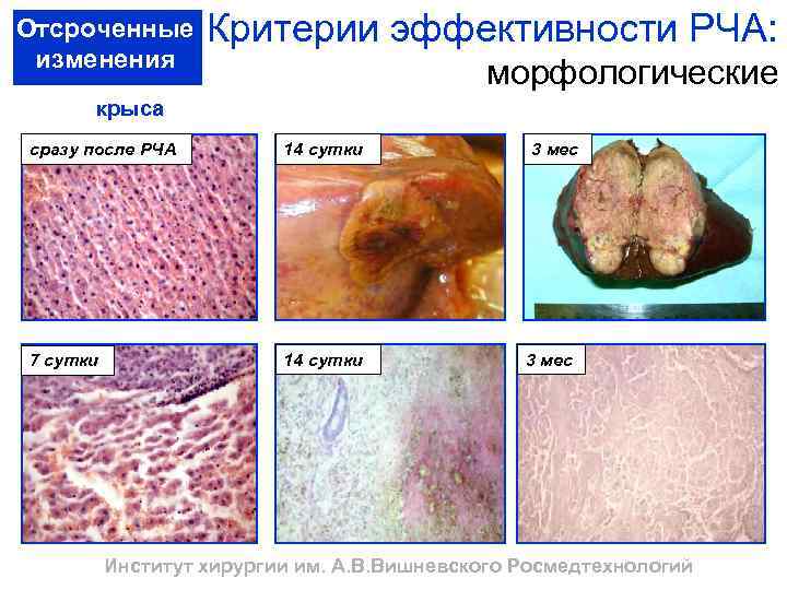 Отсроченные изменения Критерии эффективности РЧА: морфологические крыса сразу после РЧА 14 сутки 7 сутки