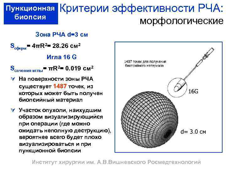 Пункционная биопсия Критерии эффективности РЧА: морфологические Зона РЧА d=3 cм Scферы= 4πR 2= 28.