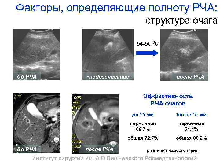 Рча сердца форум