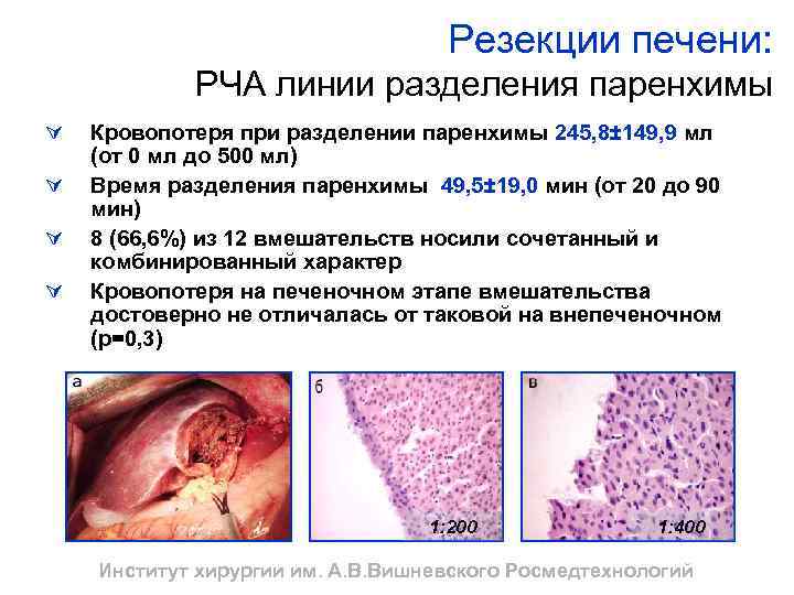 Резекции печени: РЧА линии разделения паренхимы Ú Ú Кровопотеря при разделении паренхимы 245, 8±