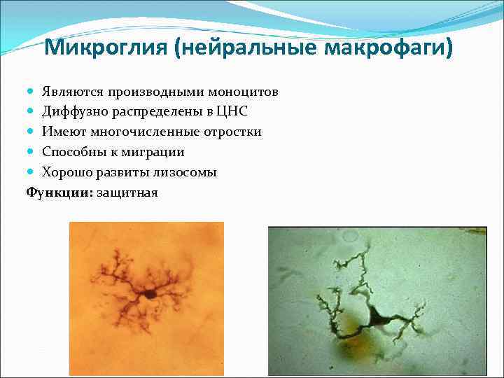 Микроглия (нейральные макрофаги) Являются производными моноцитов Диффузно распределены в ЦНС Имеют многочисленные отростки Способны