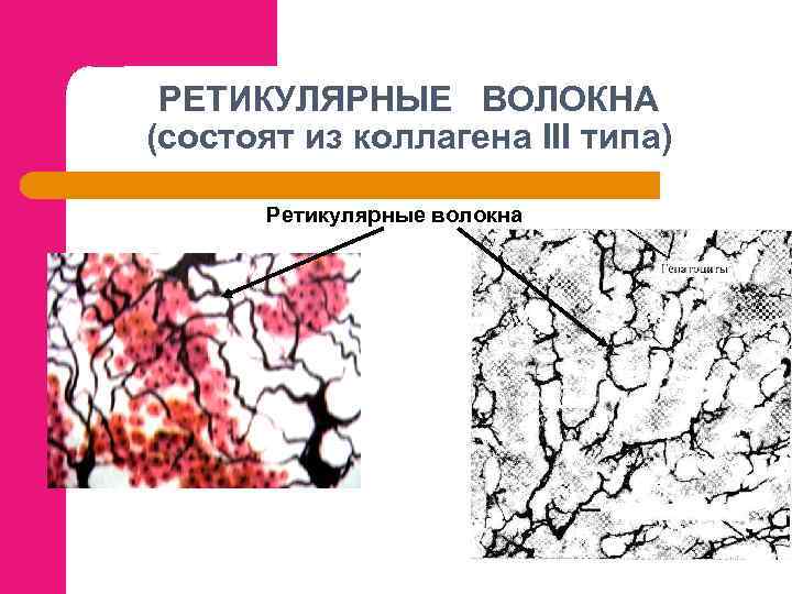 РЕТИКУЛЯРНЫЕ ВОЛОКНА (состоят из коллагена III типа) Ретикулярные волокна 