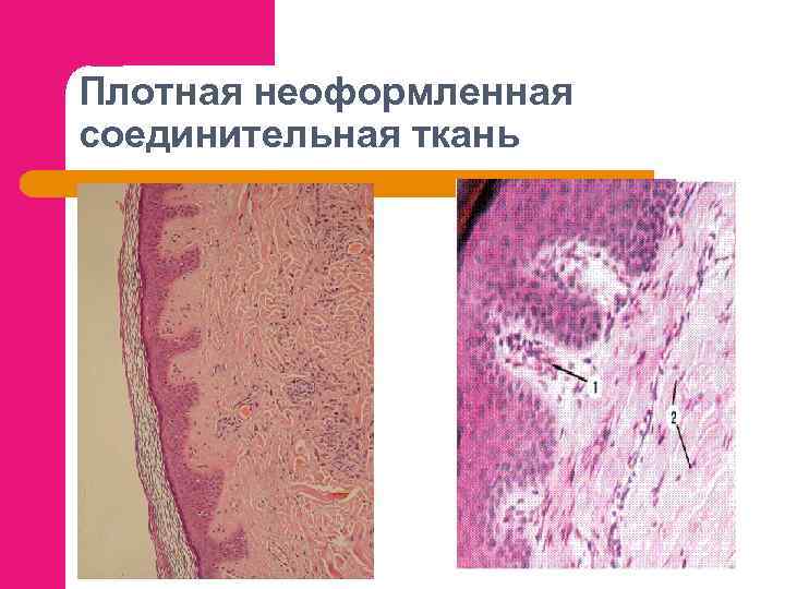 Плотная неоформленная соединительная ткань