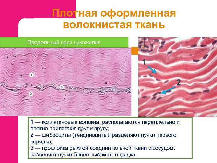 Сухожилия образованы из ткани