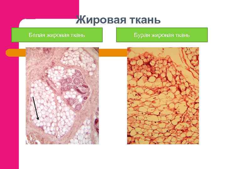 Жировая ткань Белая жировая ткань Бурая жировая ткань 