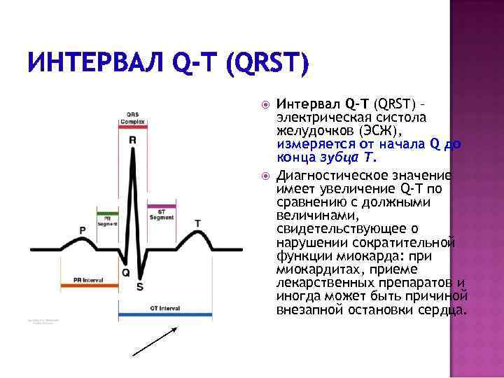 ИНТЕРВАЛ Q-T (QRST) Интервал Q-T (QRST) – электрическая систола желудочков (ЭСЖ), измеряется от начала