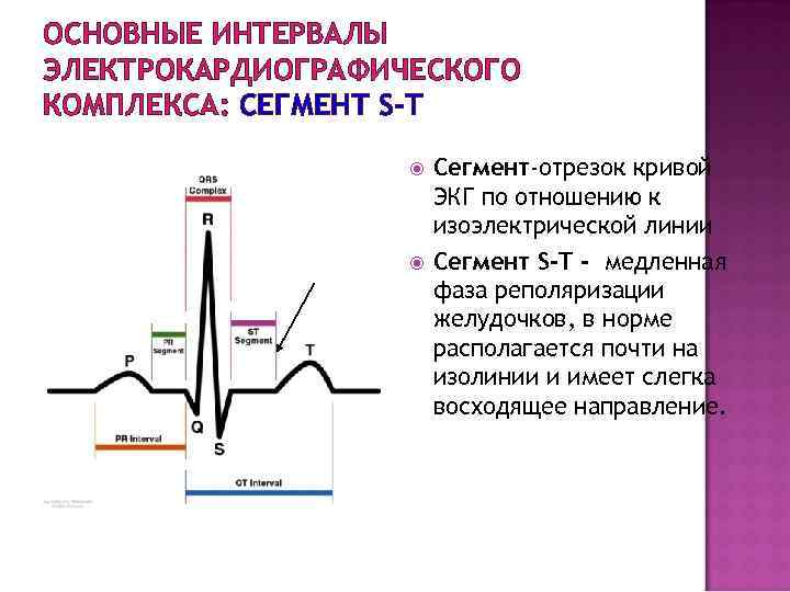 Дрейф изолинии на экг что это