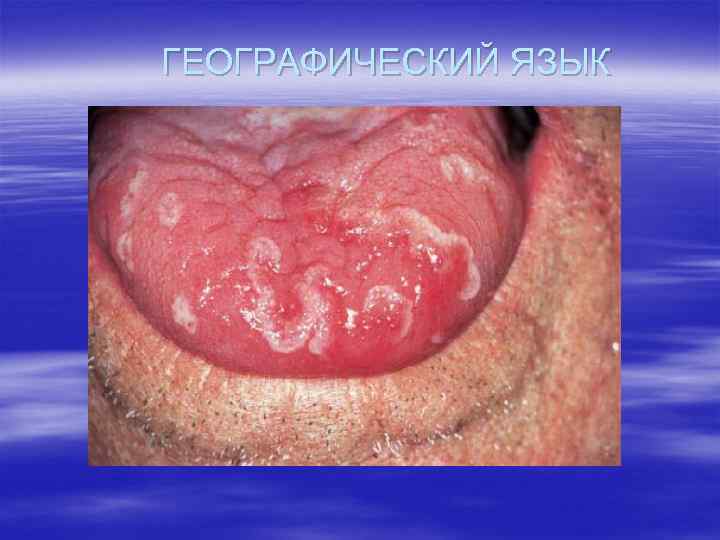 ГЕОГРАФИЧЕСКИЙ ЯЗЫК 