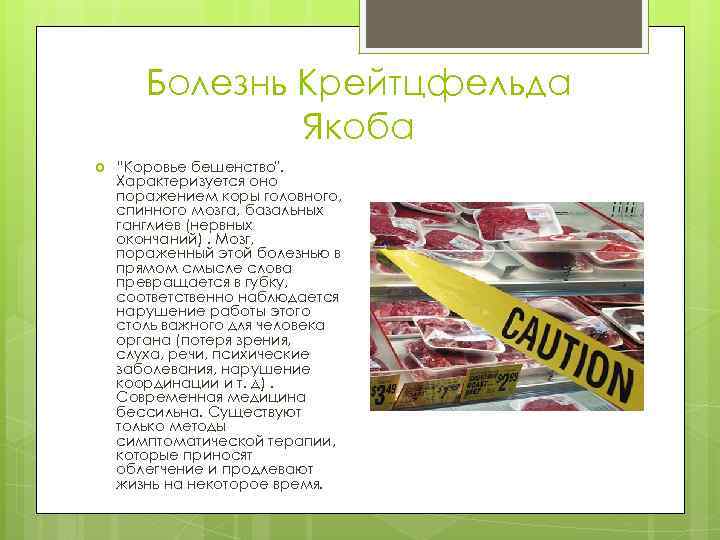 Болезнь Крейтцфельда Якоба “Коровье бешенство". Характеризуется оно поражением коры головного, спинного мозга, базальных ганглиев