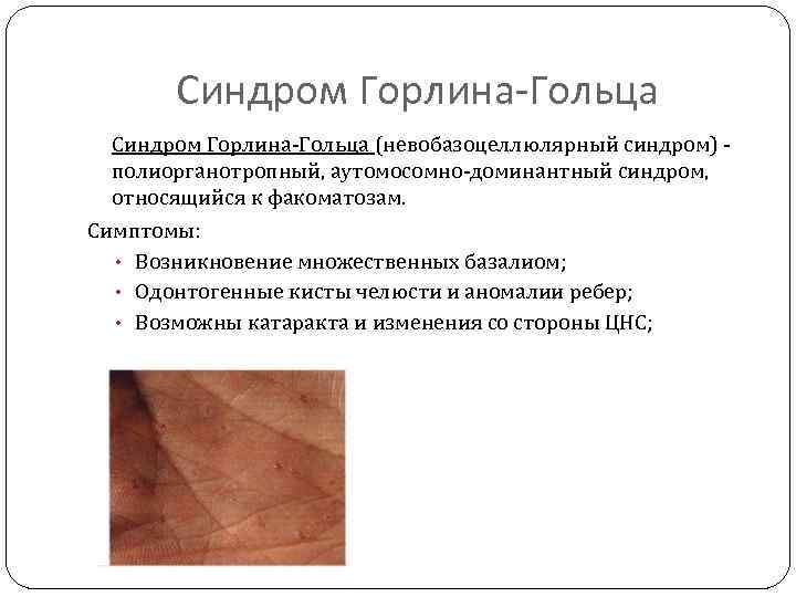 Синдром Горлина-Гольца (невобазоцеллюлярный синдром) - полиорганотропный, аутомосомно-доминантный синдром, относящийся к факоматозам. Симптомы: • Возникновение