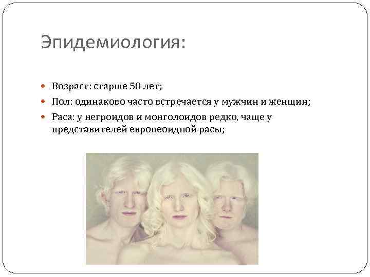 Эпидемиология: Возраст: старше 50 лет; Пол: одинаково часто встречается у мужчин и женщин; Раса: